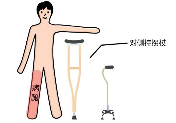 拐杖的“左右为难”——您会正确使用拐杖吗？(图2)