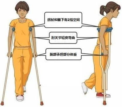 拐杖的“左右为难”——您会正确使用拐杖吗？(图4)