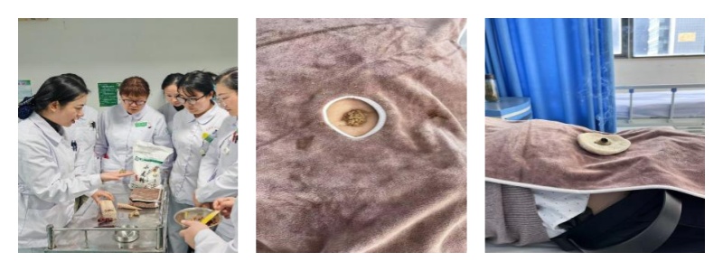 【改善护理服务 优质护理】“药之不及，针之不到，必须灸之”——脐灸调节脾胃 来一场 神“脐”之旅  (图1)