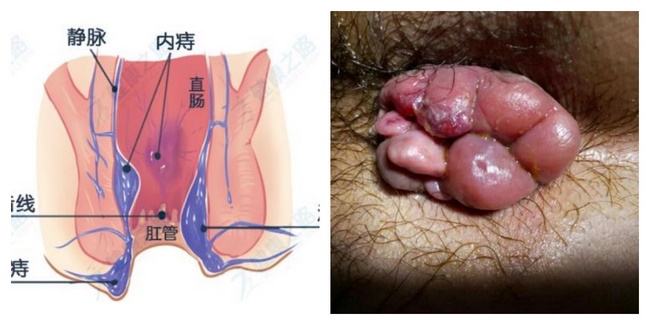 肛肠1 (Copy).jpg